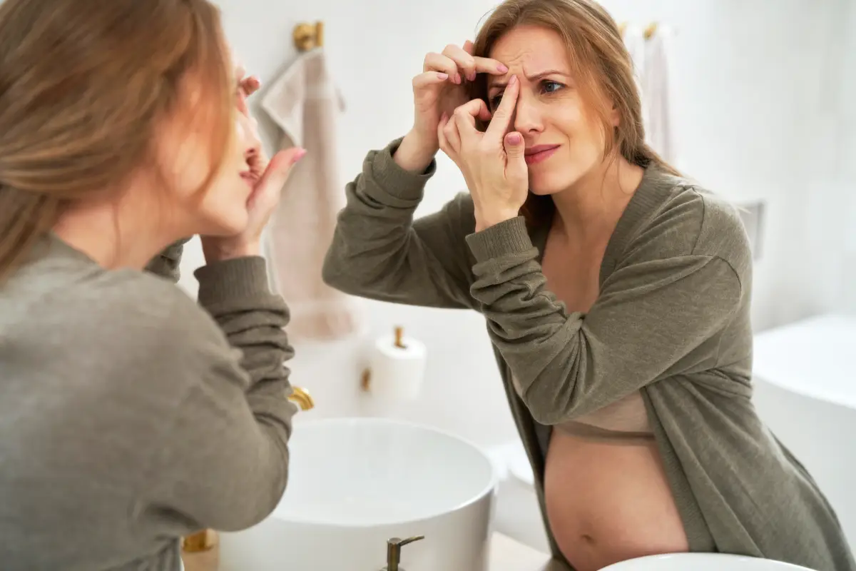 L'acné de grossesse : comment la traiter naturellement ?